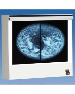 Wolf X-Ray VuPlus Mammography Viewer