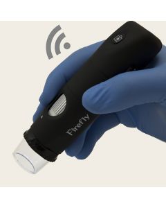 Firefly DE350 Handheld Wireless Digital Dermatoscope