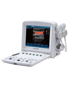 Edan U50 prime Portable Ultrasound System